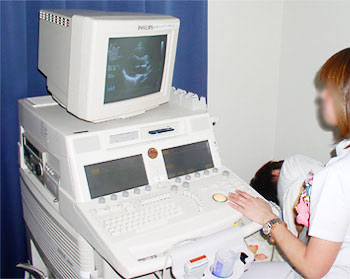 心臓超音波検査装置
